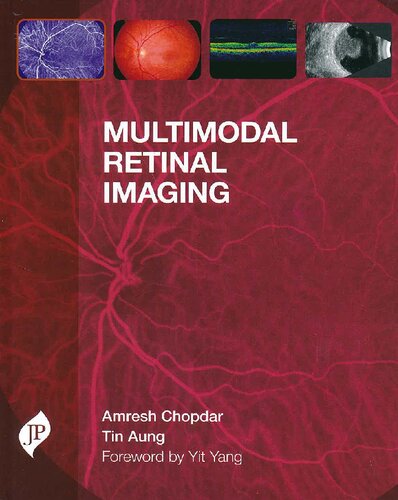 Multimodal Retinal Imaging 2014