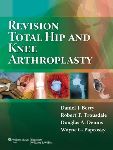 Revision Total Hip and Knee Arthroplasty 2012