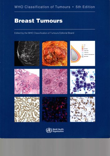 WHO Classification of Breast Tumours: WHO Classification of Tumours, Volume 2 2019