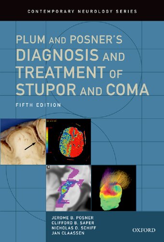 Plum and Posner's Diagnosis and Treatment of Stupor and Coma 2019