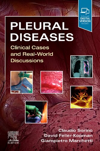 Pleural Diseases,E-Book: Clinical Cases and Real-World Discussions 2021