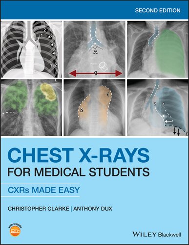 Chest X-Rays for Medical Students: CXRs Made Easy 2020