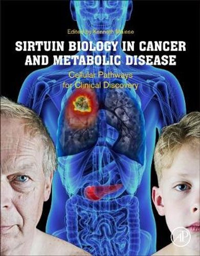 زیست شناسی سیرتوئین در سرطان و بیماری های متابولیک: مسیرهای سلولی برای کشف بالینی