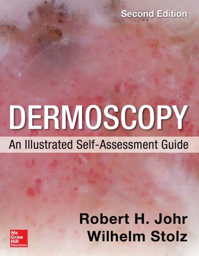 Dermoscopy: An Illustrated Self-Assessment Guide, 2/e 2015