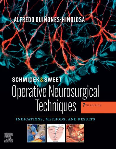 Schmidek and Sweet: Operative Neurosurgical Techniques 2-Volume Set: Indications, Methods and Results 2021