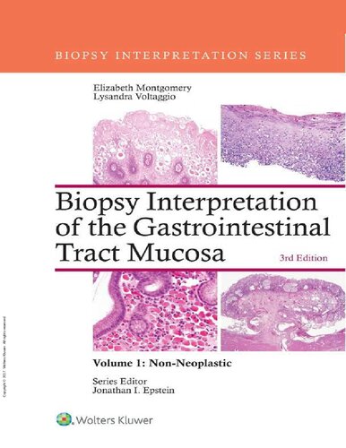 Biopsy Interpretation of the Gastrointestinal Tract Mucosa 2017
