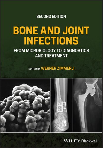 Bone and Joint Infections: From Microbiology to Diagnostics and Treatment 2021
