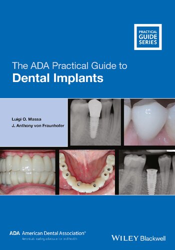The ADA Practical Guide to Dental Implants 2021