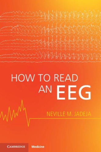 How to Read an EEG 2021