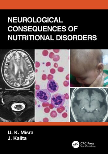 Neurological Consequences of Nutritional Disorders 2021