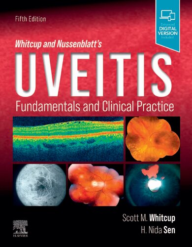 Whitcup and Nussenblatt's Uveitis: Fundamentals and Clinical Practice 2021