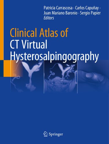 Clinical Atlas of CT Virtual Hysterosalpingography 2021
