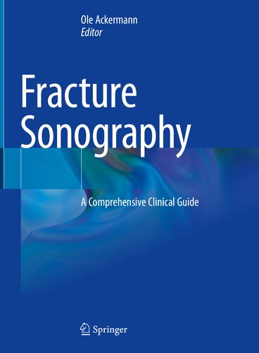 Fracture Sonography: A Comprehensive Clinical Guide 2021