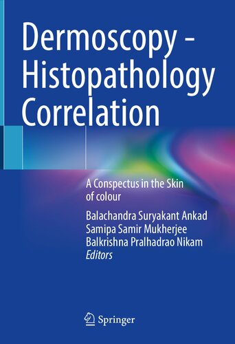Dermoscopy - Histopathology Correlation: A Conspectus in the Skin of colour 2021