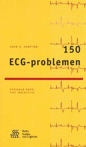 150 ECG-problemen 2016