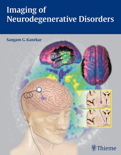 Imaging of Neurodegenerative Disorders 2015