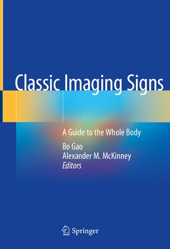 Classic Imaging Signs: A Guide to the Whole Body 2020