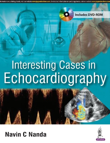 Interesting Cases in Echocardiography 2017