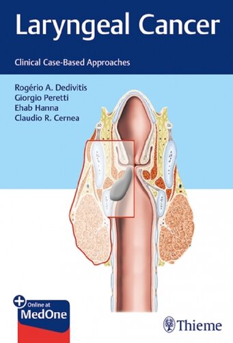 Laryngeal Cancer: Clinical Case-Based Approaches 2018