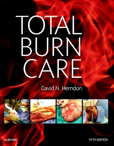 Total Burn Care 2017