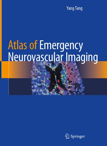 Atlas of Emergency Neurovascular Imaging 2020