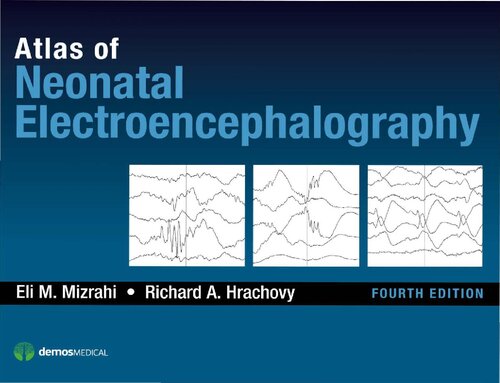 Atlas of Neonatal Electroencephalography, Fourth Edition 2015