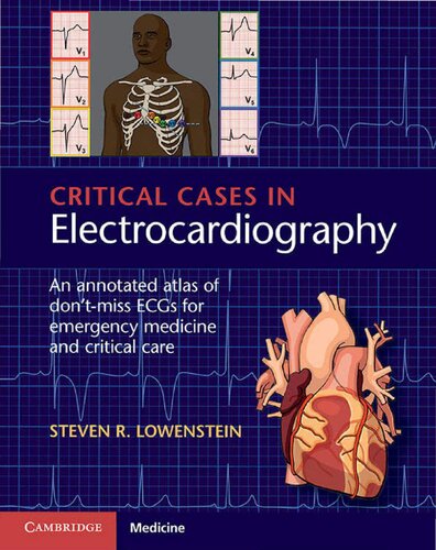 Critical Cases in Electrocardiography: An Annotated Atlas of Don't-Miss ECGs for Emergency Medicine and Critical Care 2018