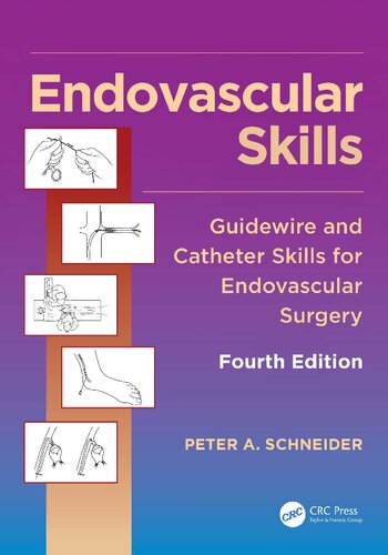 Endovascular Skills: Guidewire and Catheter Skills for Endovascular Surgery, Fourth Edition 2019