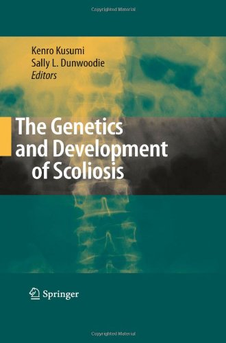 The Genetics and Development of Scoliosis 2009