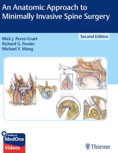 An Anatomic Approach to Minimally Invasive Spine Surgery 2018