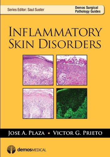 Inflammatory Skin Disorders 2012