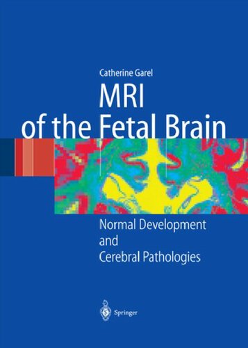 تصویربرداری رزونانس مغناطیسی مغز جنین: رشد طبیعی و آسیب شناسی مغز