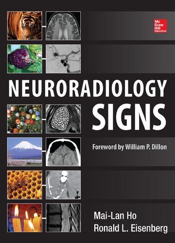 Neuroradiology Signs 2014