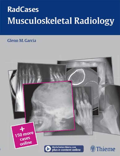 Musculoskeletal Radiology 2010