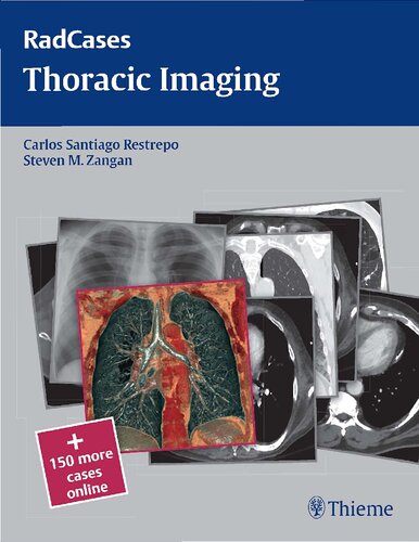 Thoracic Imaging 2011