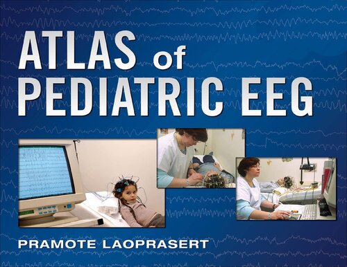 Atlas of Pediatric EEG 2010