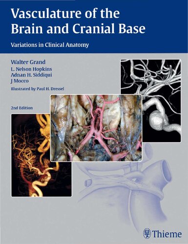 عروقی شدن مغز و پایه جمجمه: تفاوت در آناتومی بالینی