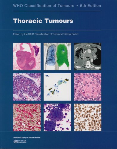 Thoracic Tumours 2021