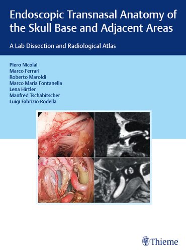 Endoscopic Transnasal Anatomy of the Skull Base and Adjacent Areas: A Lab Dissection and Radiological Atlas 2020