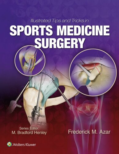 Illustrated Tips and Tricks in Sports Medicine Surgery 2018