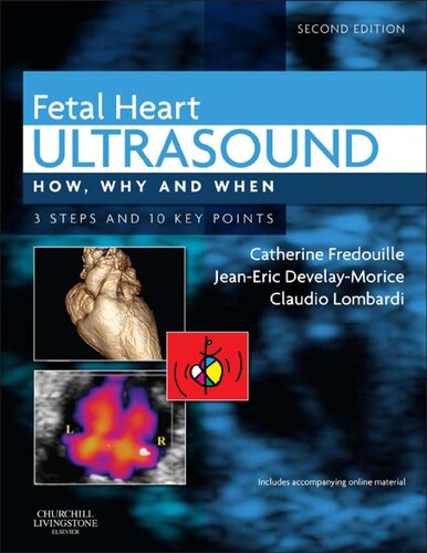 Fetal Heart Ultrasound: How, Why and When 2013