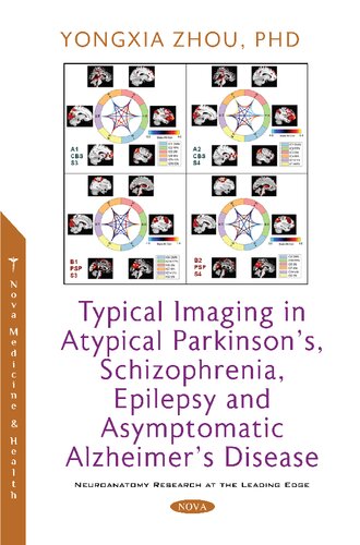 تصویربرداری معمولی از بیماری پارکینسون آتیپیک، اسکیزوفرنی، صرع و بیماری آلزایمر بدون علامت