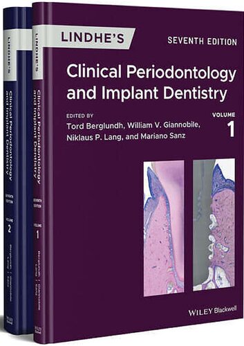 Lindhe's Clinical Periodontology and Implant Dentistry, 2 Volume Set 2021