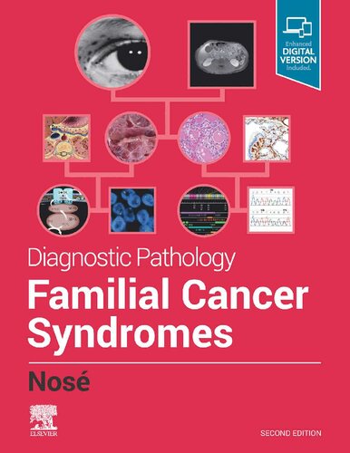 Familial Cancer Syndromes 2013