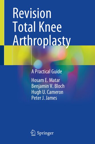 Revision Total Knee Arthroplasty: A Practical Guide 2021