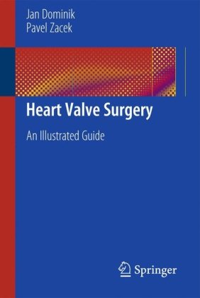 Heart Valve Surgery: An Illustrated Guide 2010