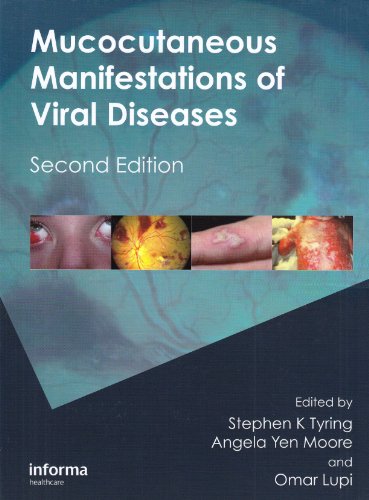 Mucocutaneous Manifestations of Viral Diseases: An Illustrated Guide to Diagnosis and Management 2010
