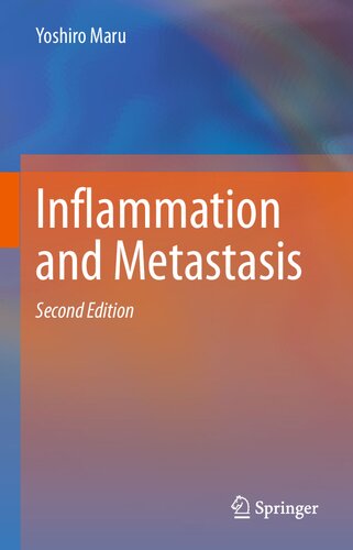 Inflammation and Metastasis 2021