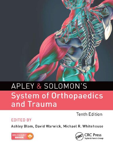 Apley and Solomon's System of Orthopaedics and Trauma 2017