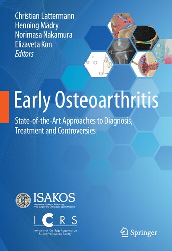 Early Osteoarthritis: State-of-the-Art Approaches to Diagnosis, Treatment and Controversies 2021
